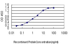 IHC-plus™ Monoclonal Mouse anti-Human EBF3 / COE3 Antibody (clone 8D6, IHC, WB)