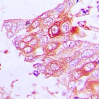 Polyclonal Rabbit anti-Human MUC13 Antibody (C-Terminus, IHC, IF, WB)