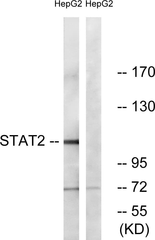 STAT2 Antibody (aa656-705)