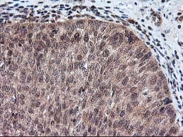FGF21 Antibody (clone OTI2F10)