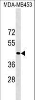 OR1N2 Antibody (aa1-30)