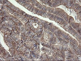 PHF7 Antibody (aa155-381, clone OTI1A2)