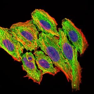 CCL2 / MCP1 Antibody (clone 2D8)