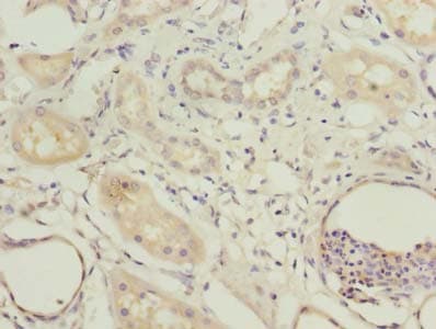 Polyclonal Rabbit anti-Human COBLL1 Antibody (IHC)