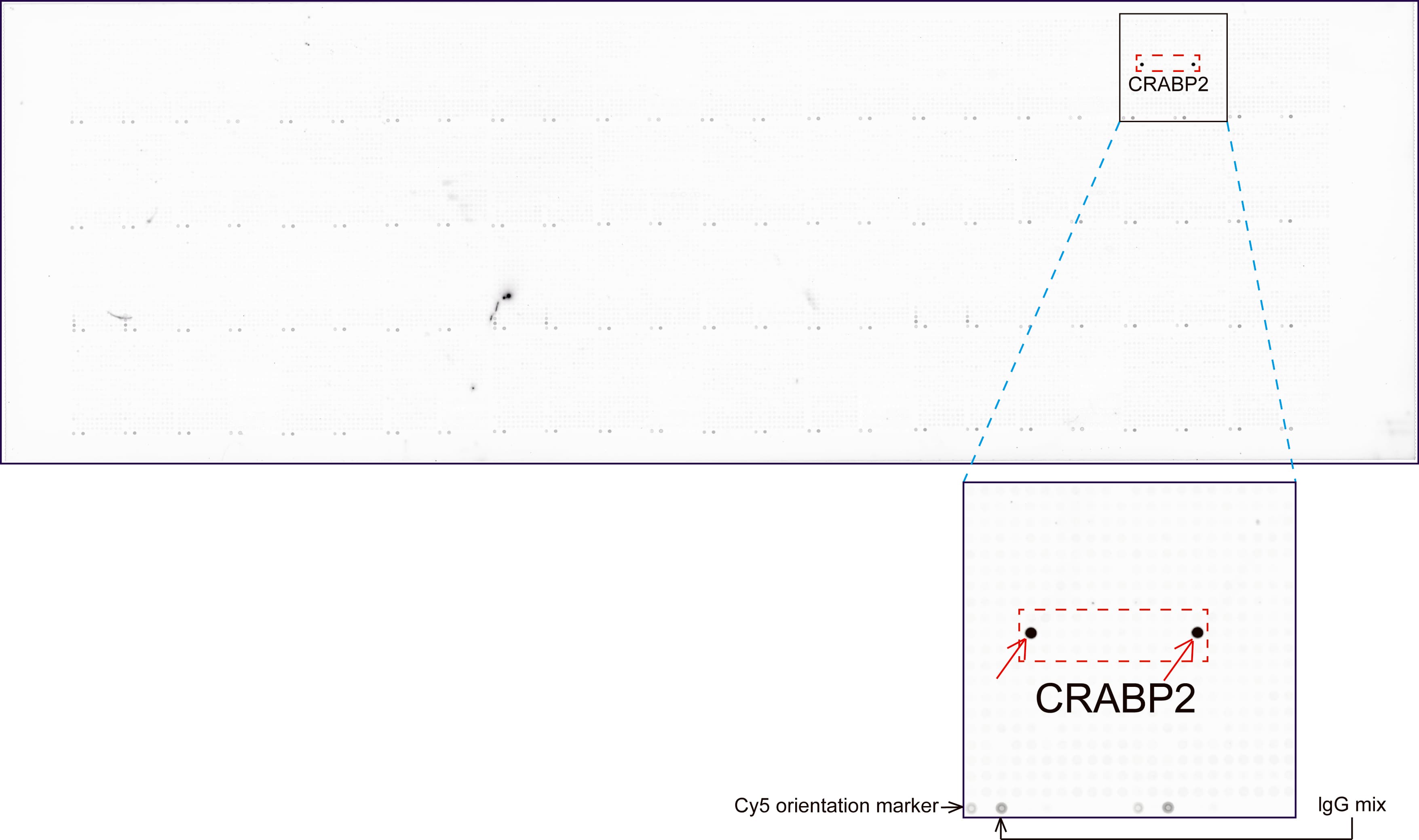CRABP2 Antibody (clone UMAB176)