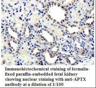 Aprataxin / APTX Antibody (aa13-254)