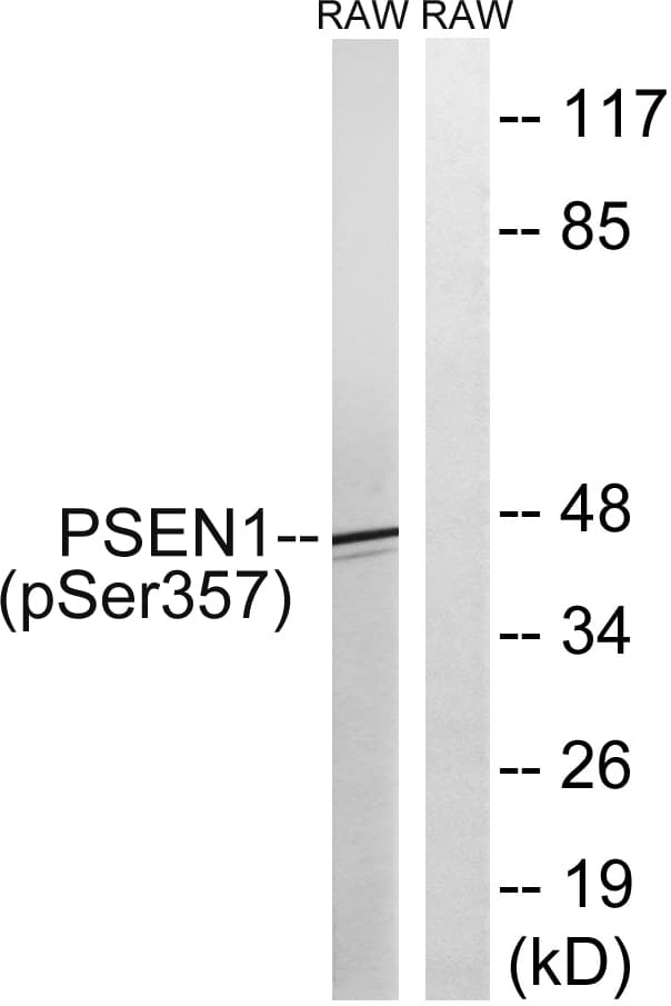 PSEN1 / Presenilin 1 Antibody (phospho-Ser357)