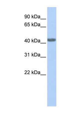 Polyclonal Rabbit anti-Human CCR2 Antibody (aa216-265, WB)