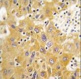 CAMK1D Antibody (aa302-333)
