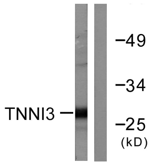 TNNI3 / Cardiac Troponin I Antibody (aa5-54)