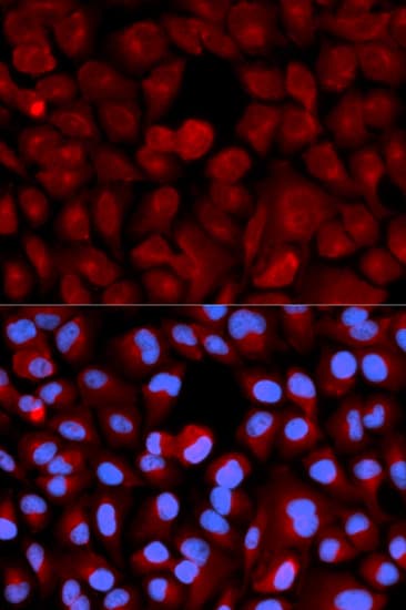 TCEB2 / Elongin B Antibody