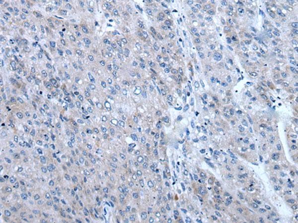 ZIC / ZIC1 Antibody