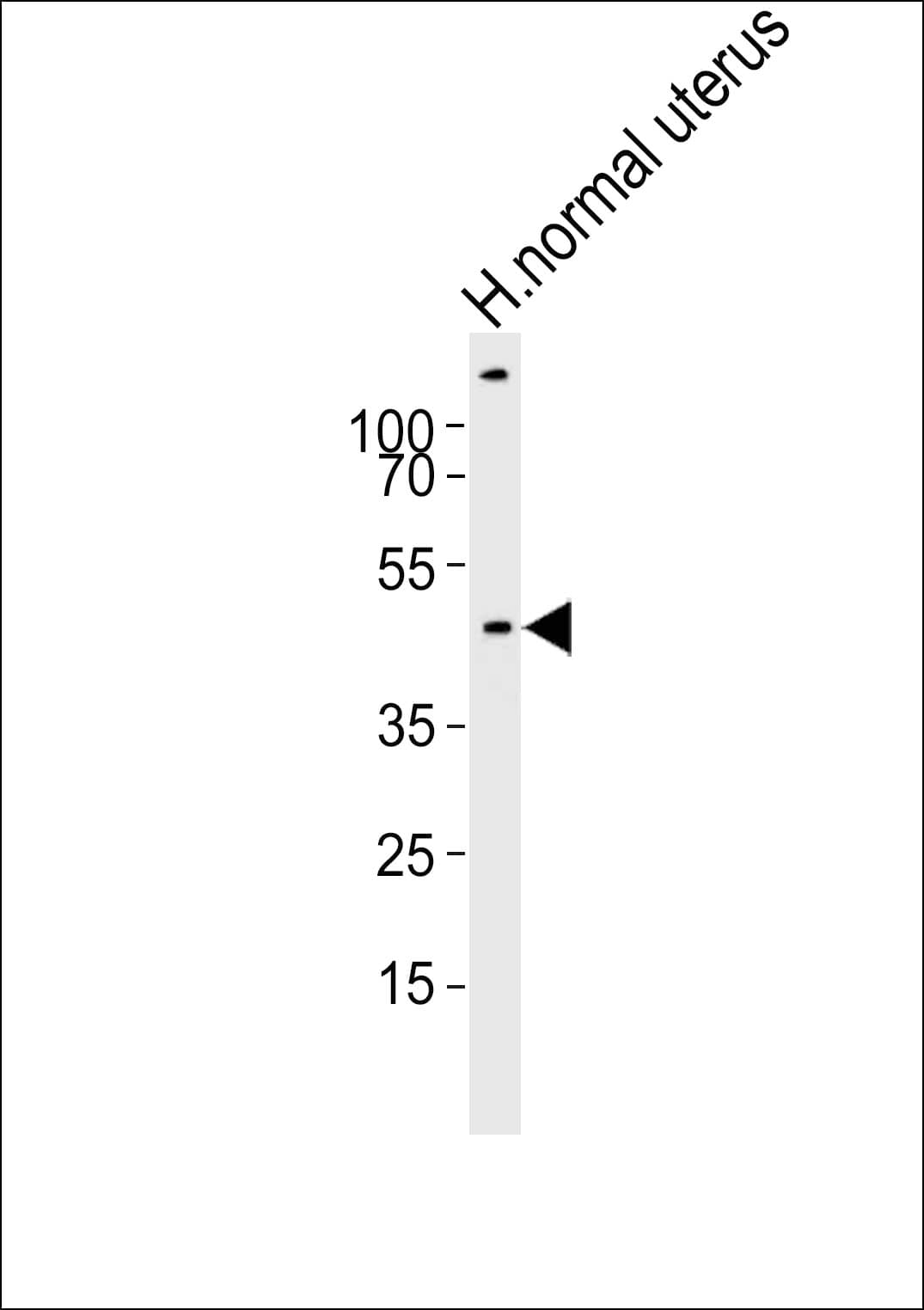 Polyclonal Rabbit anti-Human CERKL Antibody (aa94-127, WB)