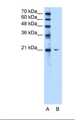 RAB5IF Antibody (N-Terminus)