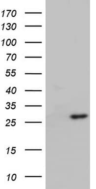ITGB1BP1 / ICAP1 Antibody (clone OTI7E8, Carrier-free)