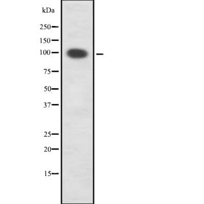 PRKD2 / PKD2 Antibody