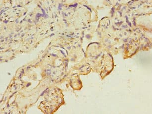 CA13 / Carbonic Anhydrase XIII Antibody