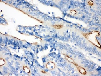 Polyclonal Rabbit anti-Human VIL1 / Villin Antibody (IHC, WB)