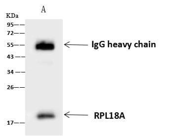 RPL18A Antibody
