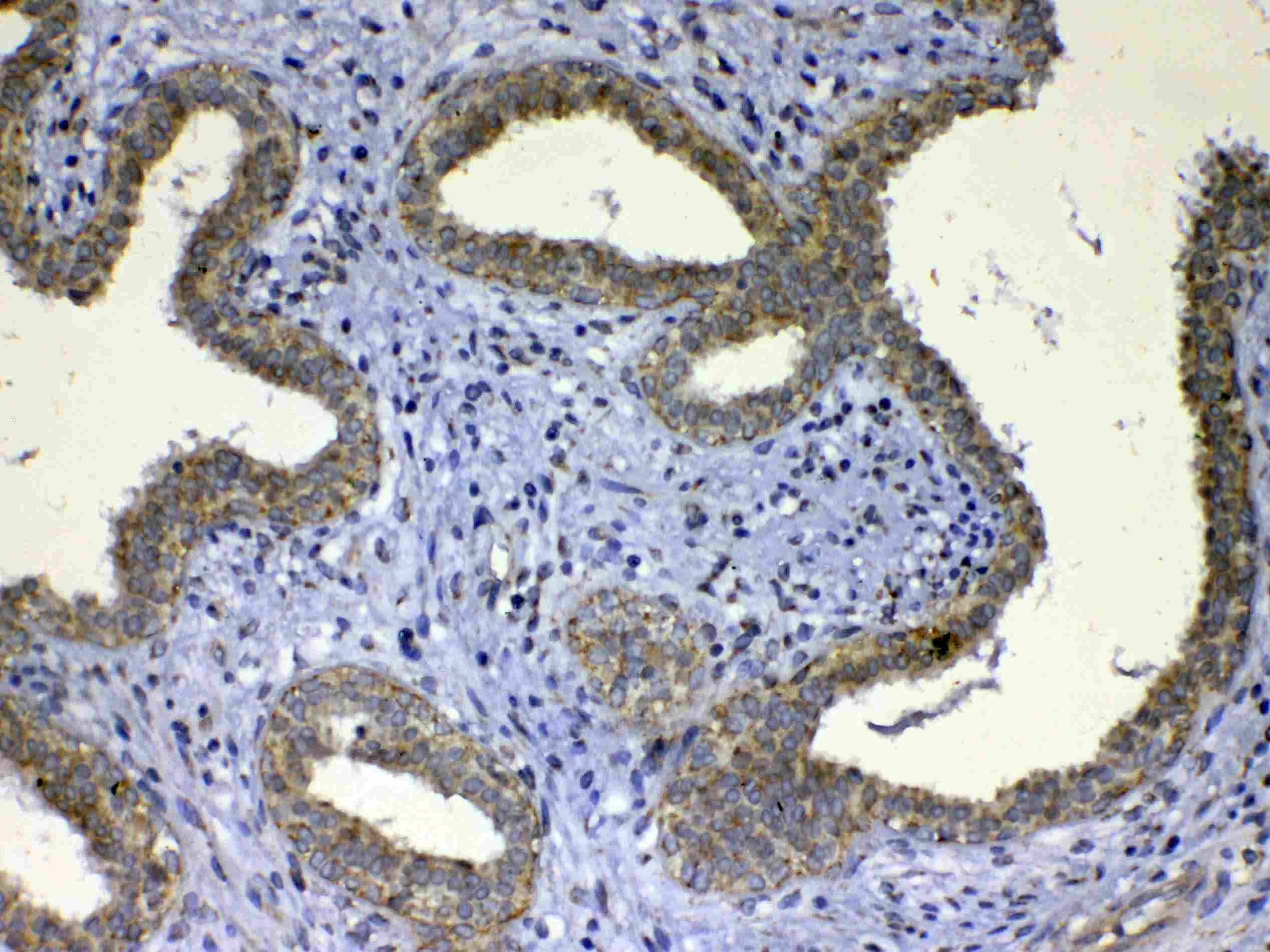 UGT1A / UGT1A1 Antibody
