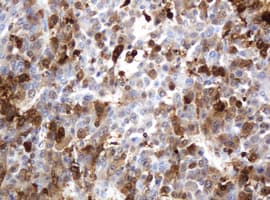 TP / Thymidine Phosphorylase Antibody (aa311-482, clone 7A6, Carrier-free)