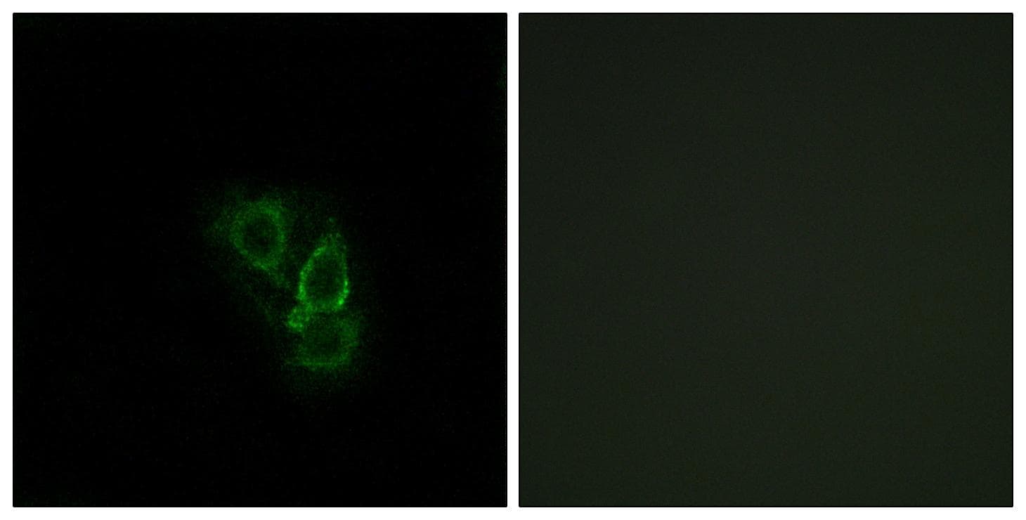 Polyclonal Rabbit anti-Human RAD1 Antibody (IHC, IF, WB)