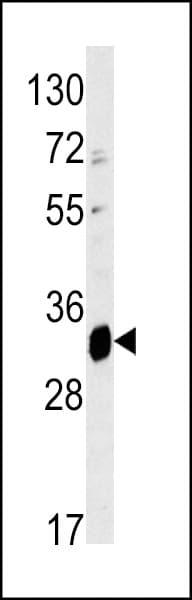 Polyclonal Rabbit anti-Human ELOVL6 Antibody (aa32-58, IHC, WB)