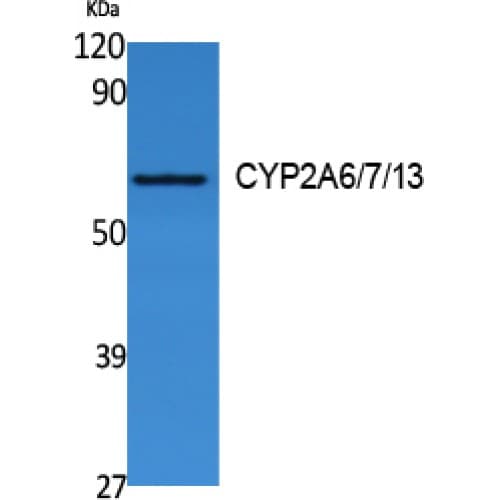CYP2A6 + CYP2A7 + CYP2A13 Antibody (Internal)