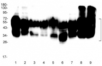Polyclonal Rabbit anti-Human Basigin / Emmprin / CD147 Antibody (IHC, WB)