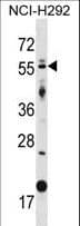 GLIS2 Antibody (aa173-202)