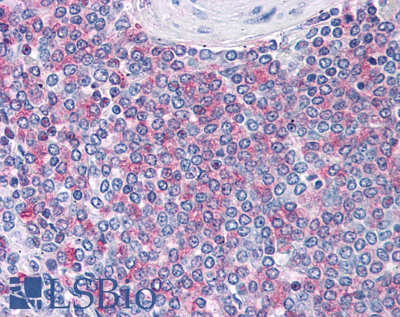 IHC-plus™ Polyclonal Rabbit anti-Human TNFAIP3 / A20 Antibody (IHC, IF, WB)