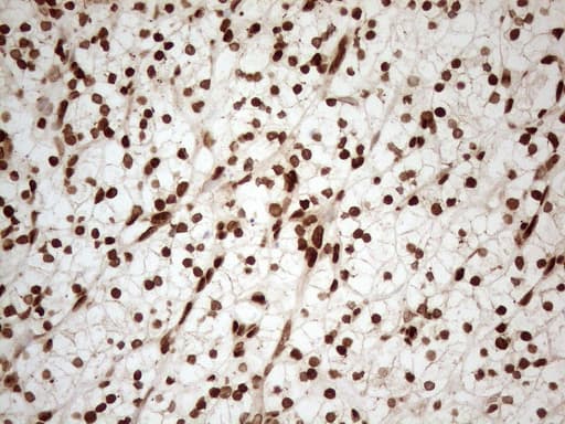 ALOX5 / 5-LOX Antibody (aa18-364, clone OTI3F1, Carrier-free)