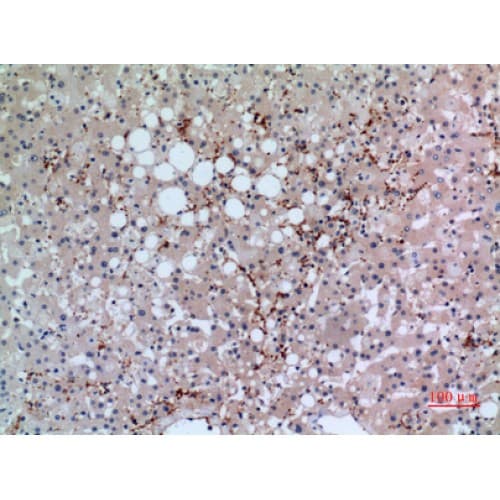 GP1BA / CD42b Antibody (261-310 aa, Internal)