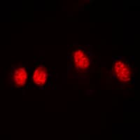 HDAC3 Antibody (phospho-Ser424)