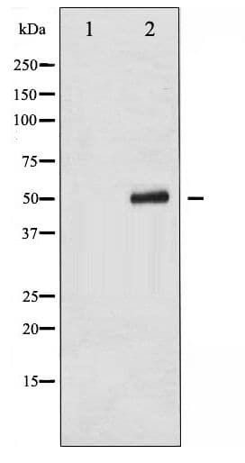 Polyclonal Rabbit anti-Human KRT8 / CK8 / Cytokeratin 8 Antibody (phospho-Ser432, IHC, IF, WB)
