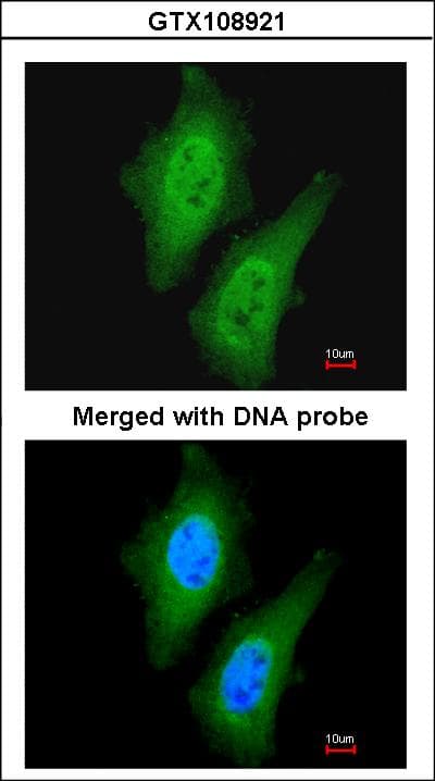 STKLD1 / SgK071 Antibody (aa438-614)