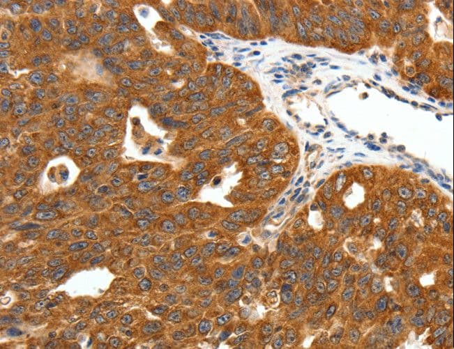 SCN11A / Nav1.9 Antibody