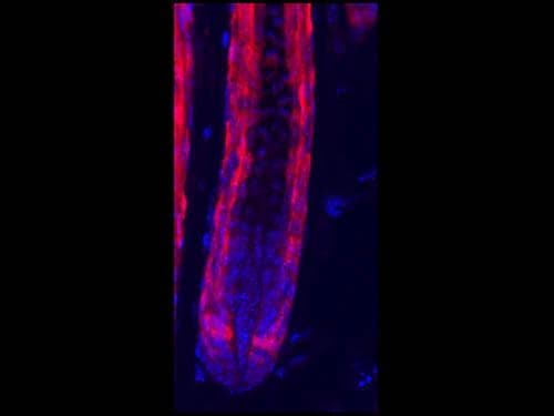Polyclonal Rabbit anti-Discosoma RFP / Red Fluorescent Protein Antibody (IHC, IF, WB)