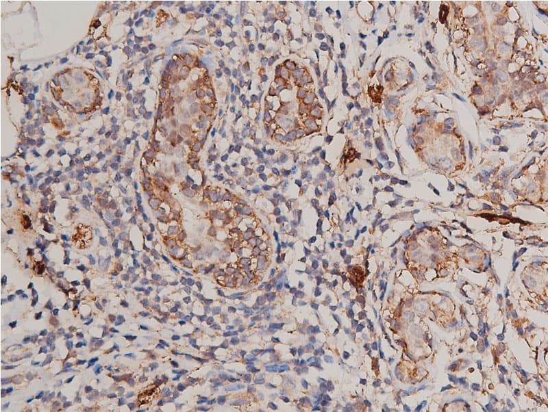 FLT1 / VEGFR1 Antibody