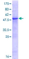 Human GGTLA4 / GGTLC1 Protein (Recombinant GST)