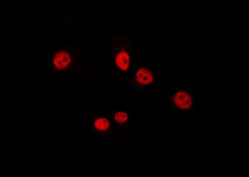 Polyclonal Rabbit anti-Human ARX Antibody (IF, WB)