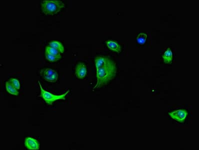 DNAL4 / Dynein Light Chain 4 Antibody
