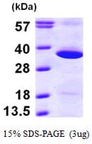 Human GNPDA1 Protein (Recombinant His)