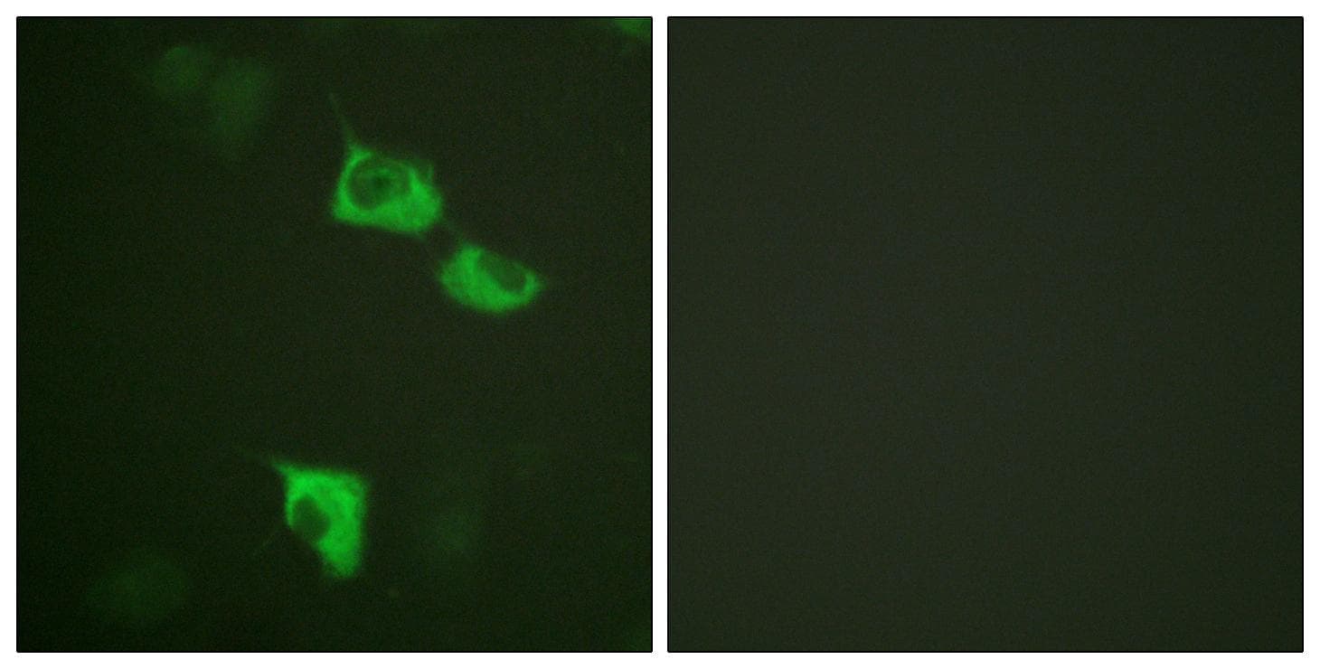 EEF2 / Elongation Factor 2 Antibody (p56)