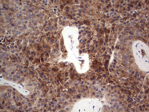 FCMR / FAIM3 Antibody (clone OTI1E6)