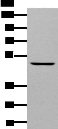 DAPK2 / DAP Kinase 2 Antibody