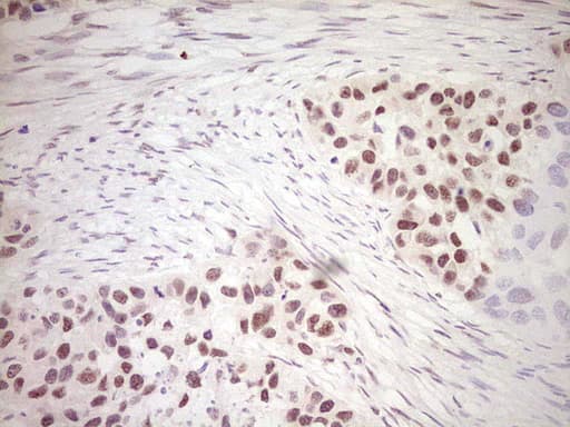 Monoclonal Mouse anti-Human DVL2 / Dishevelled 2 Antibody (clone OTI2D11, Carrier-free, aa1-320, IHC)