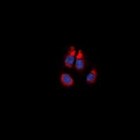 Polyclonal Rabbit anti-Human ADRA1A Antibody (C-Terminus, IHC, IF, WB)