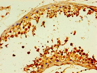 DCP2 Antibody (aa1-385)
