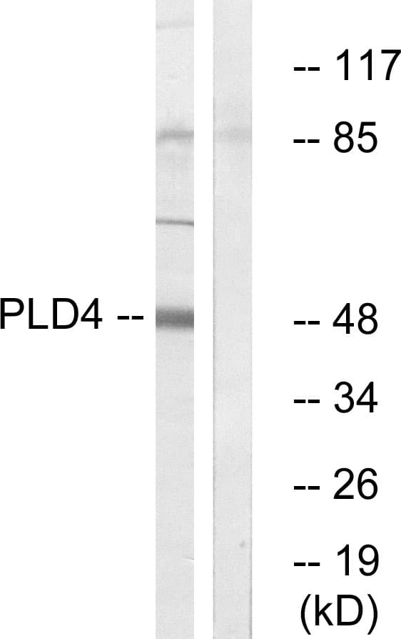 IHC-plus™ Polyclonal Rabbit anti-Human PLD4 / Phospholipase D4 Antibody (aa457-506, IHC, WB)